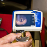 Airway Management in Emergency Setting