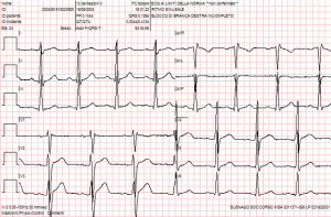 ecg_busnagosoccorso